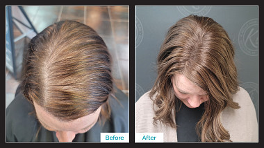 Before & After Topper